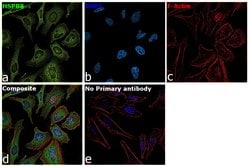 Invitrogen HSPB8 Recombinant Rabbit Monoclonal Antibody (JJ08-53) 100 &mu;L;