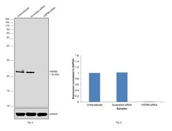 Invitrogen HSPB8 Recombinant Rabbit Monoclonal Antibody (JJ08-53) 100 &mu;L;