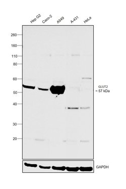 Invitrogen GLUT2 Recombinant Rabbit Monoclonal Antibody (JJ20-21) 100 &mu;L;