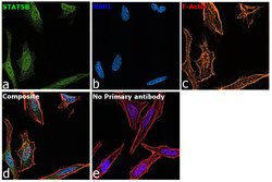 Invitrogen STAT5 alpha/beta Recombinant Rabbit Monoclonal Antibody (JJ08-78) 100 &mu;L | Buy Online | Invitrogen&trade; | Fisher Scientific
