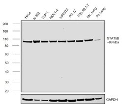 Invitrogen STAT5 alpha/beta Recombinant Rabbit Monoclonal Antibody (JJ08-78) 100 &mu;L | Buy Online | Invitrogen&trade; | Fisher Scientific