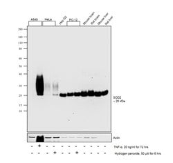 Invitrogen SOD2 (MnSOD) Recombinant Rabbit Monoclonal Antibody (JJ089-02)