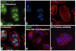 Invitrogen MGMT Recombinant Rabbit Monoclonal Antibody (JJ089-6) 100 &mu;L | Buy Online | Invitrogen&trade; | Fisher Scientific