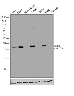 Invitrogen MGMT Recombinant Rabbit Monoclonal Antibody (JJ089-6) 100 &mu;L | Buy Online | Invitrogen&trade; | Fisher Scientific