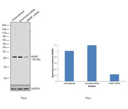 Invitrogen MGMT Recombinant Rabbit Monoclonal Antibody (JJ089-6) 100 &mu;L | Buy Online | Invitrogen&trade; | Fisher Scientific