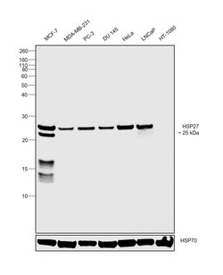 Invitrogen HSP27 Recombinant Rabbit Monoclonal Antibody (JJ09-13) 100 &mu;L;