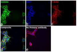 Invitrogen S100A6 Recombinant Rabbit Monoclonal Antibody (JF0976) 100 &mu;L;