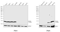 Invitrogen S100A6 Recombinant Rabbit Monoclonal Antibody (JF0976) 100 &mu;L;