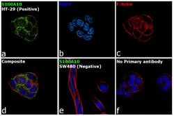 Invitrogen S100A10 Recombinant Rabbit Monoclonal Antibody (JF0987) 100 &mu;L | Buy Online | Invitrogen&trade; | Fisher Scientific