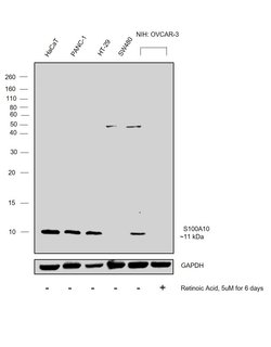 Invitrogen S100A10 Recombinant Rabbit Monoclonal Antibody (JF0987) 100 &mu;L | Buy Online | Invitrogen&trade; | Fisher Scientific