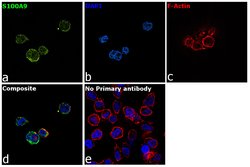Invitrogen S100A9 Recombinant Rabbit Monoclonal Antibody (JF096-8) 100