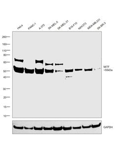 Invitrogen MiTF Recombinant Rabbit Monoclonal Antibody (JF100-01) 100 &mu;L | Buy Online | Invitrogen&trade; | Fisher Scientific