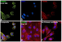 Invitrogen VAMP2 Recombinant Rabbit Monoclonal Antibody (JM11-00) 100 &mu;L;