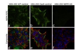Invitrogen NEFM Recombinant Rabbit Monoclonal Antibody (JM11-20) 100 &mu;L;