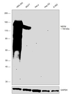 Invitrogen NEFM Recombinant Rabbit Monoclonal Antibody (JM11-20) 100 &mu;L;