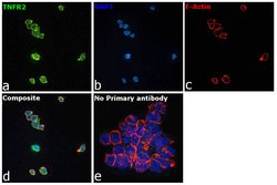 Invitrogen TNFR2 Recombinant Rabbit Monoclonal Antibody (JM113-01) 100