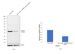 Invitrogen TDP-43 Recombinant Rabbit Monoclonal Antibody (JM51-10) 100