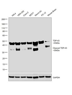 Invitrogen TDP-43 Recombinant Rabbit Monoclonal Antibody (JM51-10) 100