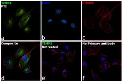 Invitrogen TIMP2 Recombinant Rabbit Monoclonal Antibody (JM87-10) 100 &mu;L;