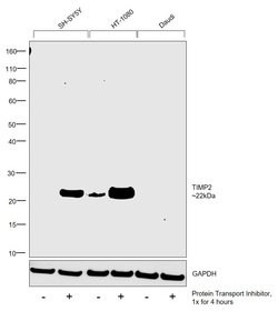 Invitrogen TIMP2 Recombinant Rabbit Monoclonal Antibody (JM87-10) 100 &mu;L;