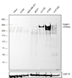 53BP1 Recombinant Rabbit Monoclonal Antibody (JA66-11), Invitrogen 100