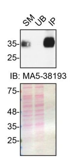 Invitrogen SFRP1 Recombinant Rabbit Monoclonal Antibody (JA11-68) 100 &mu;L;