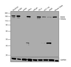 Invitrogen MSH6 Recombinant Rabbit Monoclonal Antibody (JA84-26) 100 &mu;L;