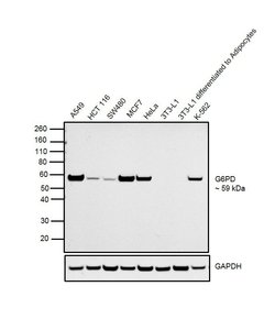 Invitrogen G6PD Recombinant Rabbit Monoclonal Antibody (JA31-40) 100 &mu;L;