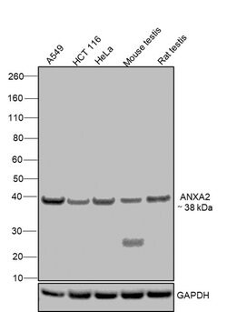 Invitrogen Annexin A2 Recombinant Rabbit Monoclonal Antibody (JA42-30)