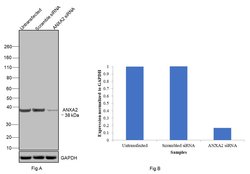 Invitrogen Annexin A2 Recombinant Rabbit Monoclonal Antibody (JA42-30)