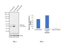 Invitrogen TRAIL-R2 (DR5) Recombinant Rabbit Monoclonal Antibody (JA03-38)