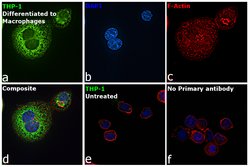 Invitrogen MMP9 Recombinant Rabbit Monoclonal Antibody (JA80-73) 100 &mu;L;