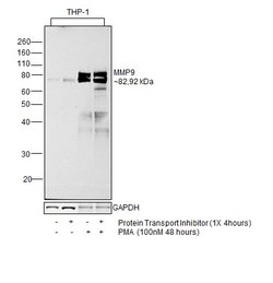 Invitrogen MMP9 Recombinant Rabbit Monoclonal Antibody (JA80-73) 100 &mu;L;