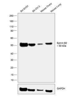 Invitrogen Ephrin B2 Recombinant Rabbit Monoclonal Antibody (JM53-21) 100