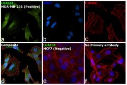 Invitrogen Galectin 1 Recombinant Rabbit Monoclonal Antibody (JM13-37)