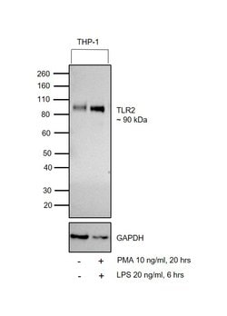 Invitrogen&trade;&nbsp;TLR2 Recombinant Rabbit Monoclonal Antibody (JM22-41)