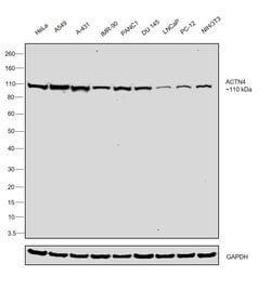 Invitrogen alpha Actinin 4 Recombinant Rabbit Monoclonal Antibody (JU20-23)
