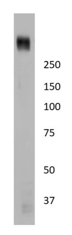 Invitrogen PIEZO1 Monoclonal Antibody (2-10) 100 &mu;L; Unconjugated:Antibodies,