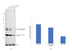 Invitrogen Cathepsin D Monoclonal Antibody (CTD-19) 100 &mu;g | Buy Online | Invitrogen&trade; | Fisher Scientific