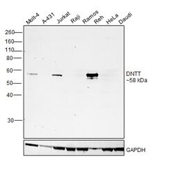Invitrogen TdT Recombinant Rabbit Monoclonal Antibody (RM379) 100 &mu;L;