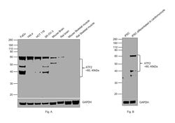 Invitrogen ATF2 Recombinant Rabbit Monoclonal Antibody (3D12) 100 &mu;L;