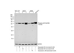 Invitrogen Phospho-p53 (Ser392) Recombinant Rabbit Monoclonal Antibody