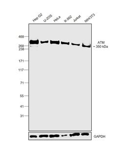 Invitrogen ATM Recombinant Rabbit Monoclonal Antibody (4E11) 100 &mu;L;