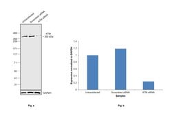 Invitrogen ATM Recombinant Rabbit Monoclonal Antibody (4E11) 100 &mu;L;