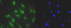 Invitrogen SRSF3 Recombinant Rabbit Monoclonal Antibody (JE46-44) 100 &mu;L;
