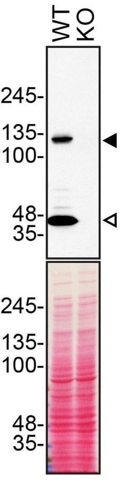 Invitrogen beta Dystroglycan Monoclonal Antibody (GT835) 100 &mu;L | Buy Online | Invitrogen&trade; | Fisher Scientific