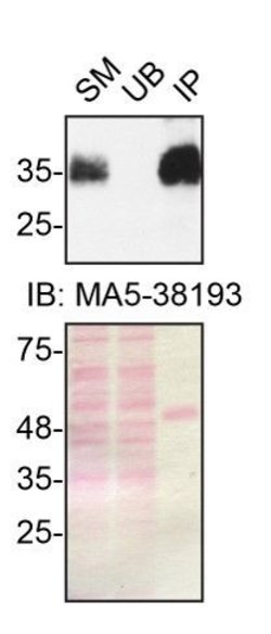 Invitrogen SFRP1 Recombinant Rabbit Monoclonal Antibody (5I6V1) 100 &mu;L;