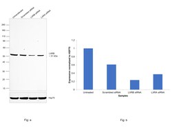 Invitrogen LXR beta Recombinant Rabbit Monoclonal Antibody (PSH0-56) 100