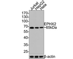 Invitrogen EPHX2 Recombinant Rabbit Monoclonal Antibody (JE64-07) 100 &mu;L | Buy Online | Invitrogen&trade; | Fisher Scientific