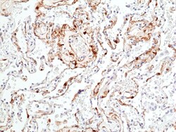 Invitrogen Phospho-ERK1/2 (Thr202, Tyr204) Recombinant Rabbit Monoclonal